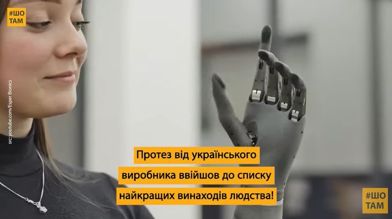 Роборука з ШІ: український біонічний протез руки став однією з провідних інновацій у світі
