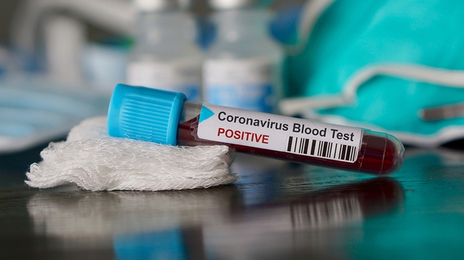 Областная инфекционная больница опровергает, что там нет тестов на коронавирус
