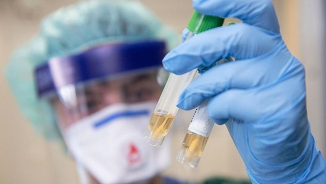 Немецкие ученые нашли способ блокировать размножение коронавируса: проведены успешные испытания на мышах, - СМИ