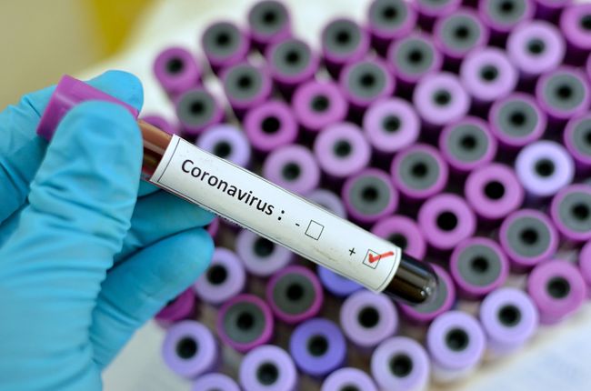 Вспышка коронавируса в Харьковоблэнерго: появились подробности о заболевших