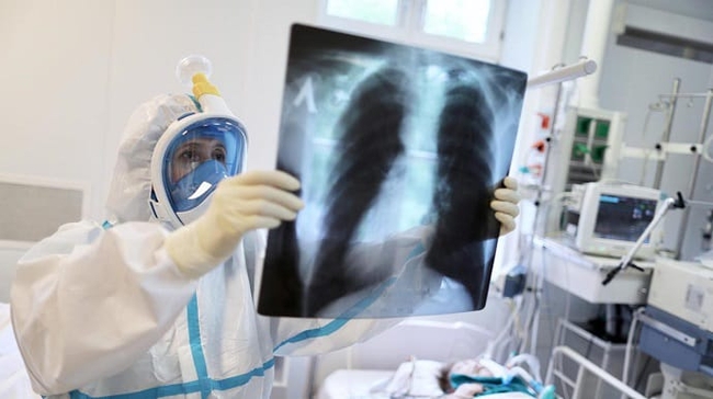 COVID-19 в Харькове “помолодел” – наблюдения главврача опорной больницы