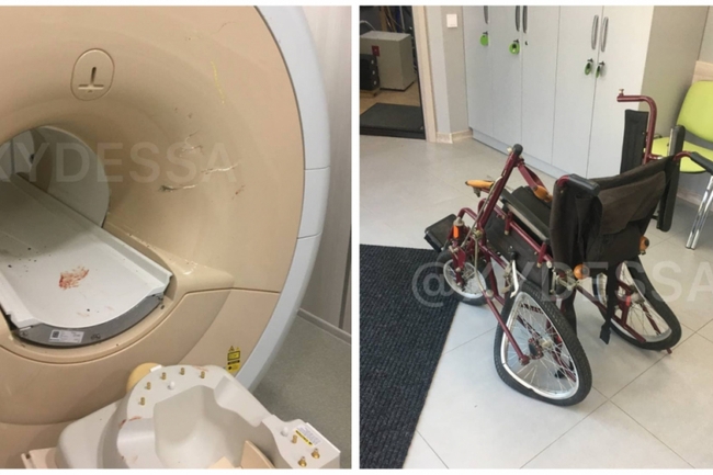 В Одесі пацієнтку засмоктав апарат МРТ (ФОТО 18+)