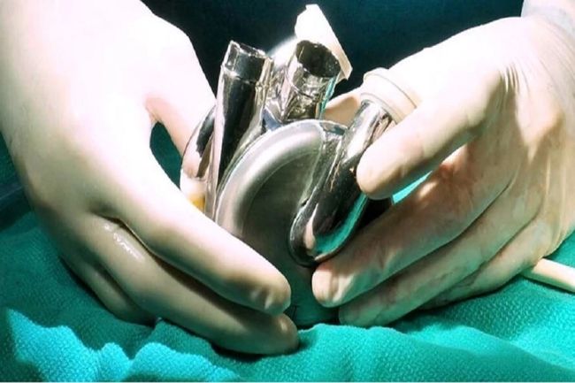 Новини з іншого світу