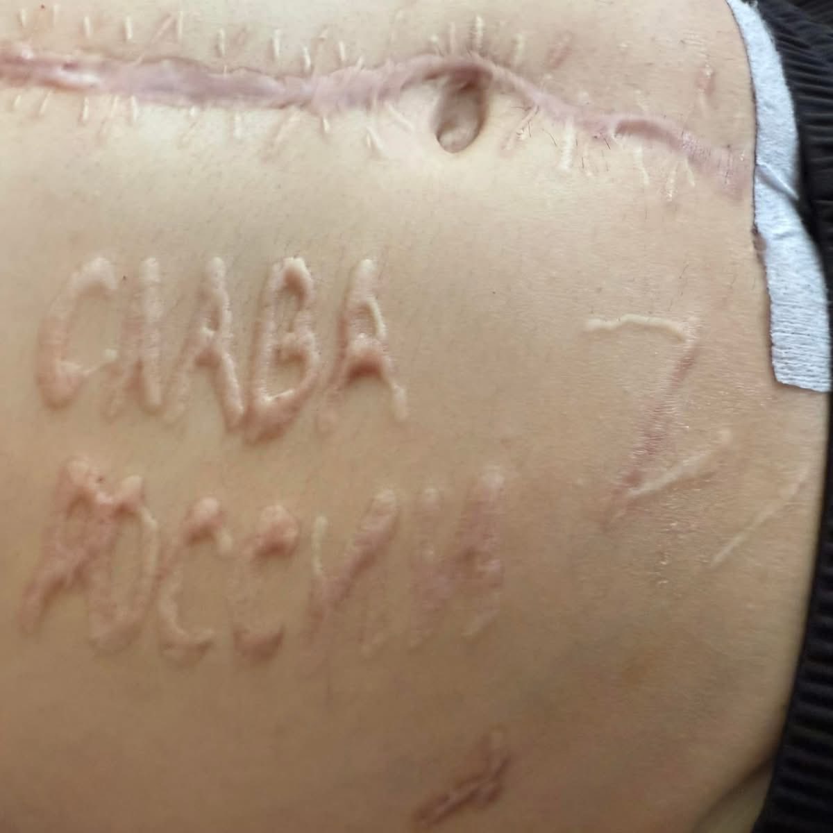 Подпись русского хирурга-садиста