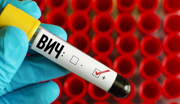 У рф – критична ситуація з ВІЛ