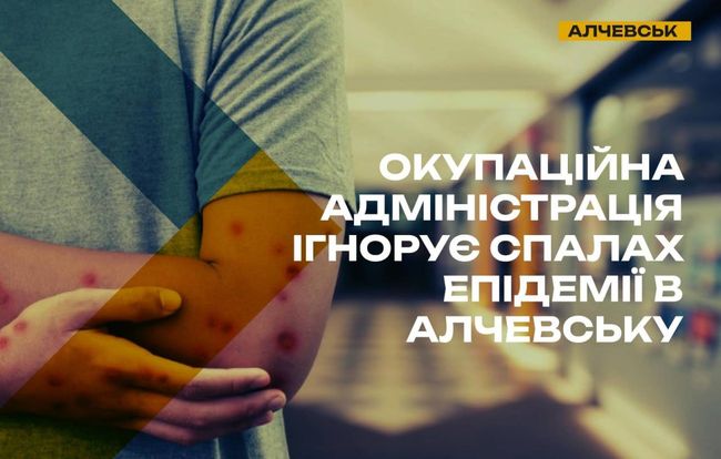 В школах тимчасово окупованого Алчевська зафіксовано масове поширення стрептодермії