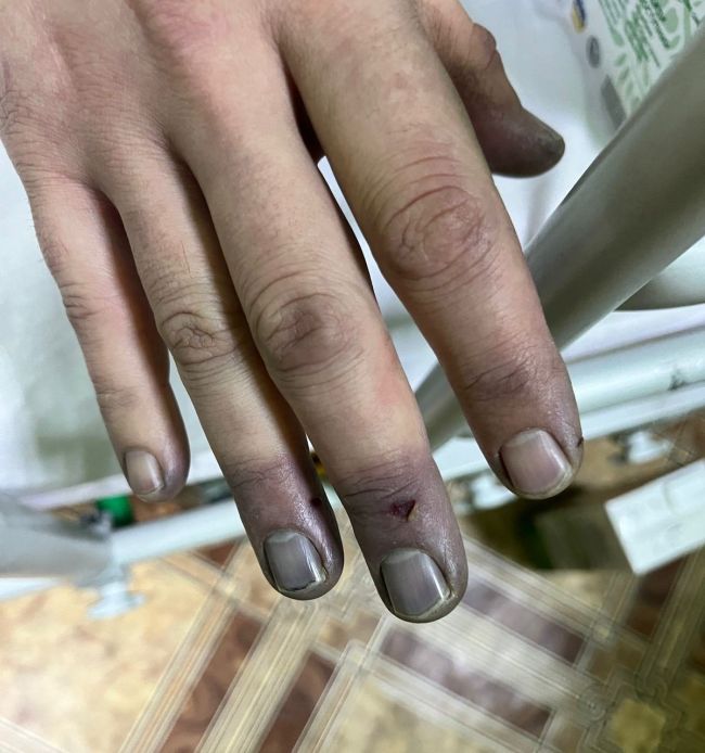 Кордон та ухилянти несумістні Кордон та ухилянти несумістні