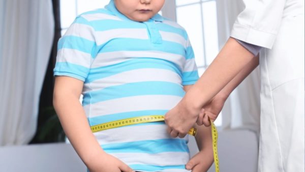 Детское ожирение: как предотвратить это
