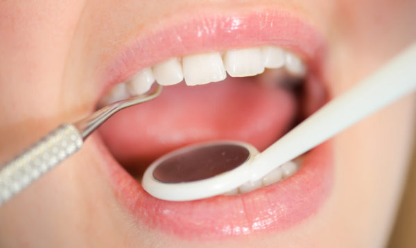 Тщательно проверяйте рот: названы признаки в полости рта, которые могут указать на рак