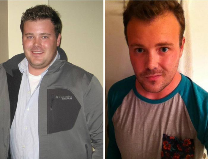 Фото «до» и «после» людей, которые перестали пить алкоголь: результат налицо