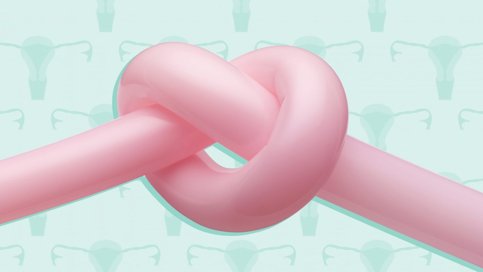 Перевязка маточных труб – метод постоянной контрацепции