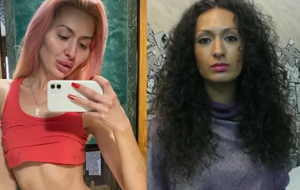 Участница украинского шоу перекачала себе скулы и губы: неужели это красота?