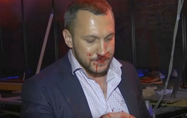 Драка депутатов до крови на украинском телеканале (фото, видео)