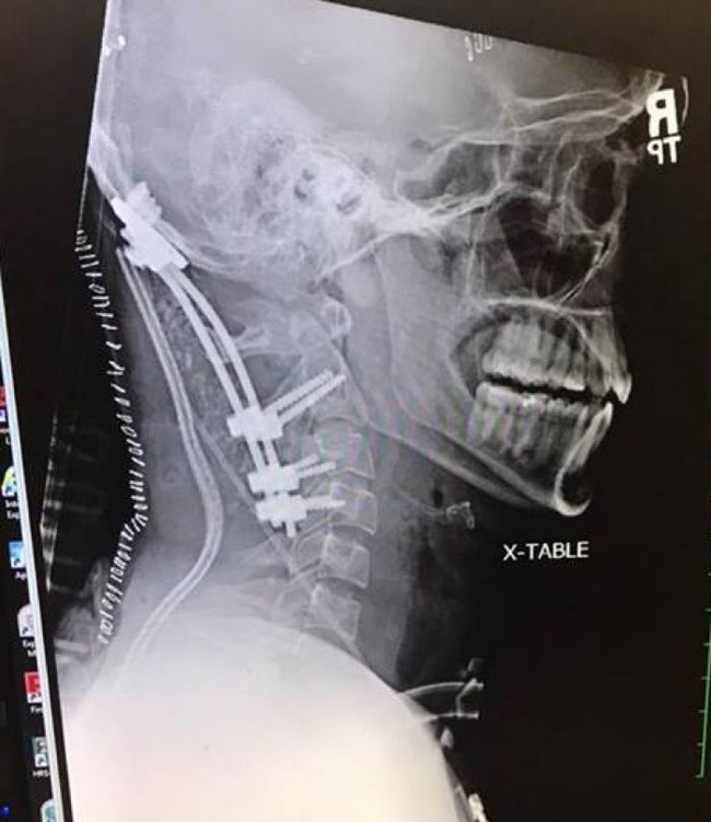 В США парень выжил после того, как ему оторвало голову (фото)
