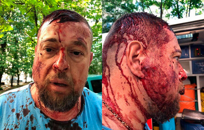 В Харькове жестоко избили активиста Национального Корпуса (фото 18+)
