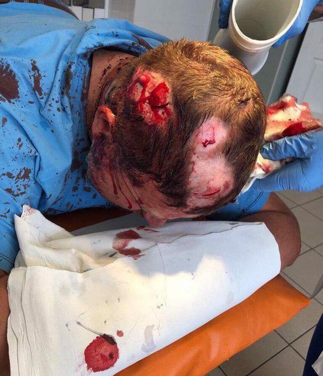 В Харькове жестоко избили активиста Национального Корпуса (фото 18+)