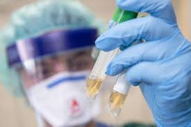 У МОЗ проведуть нараду з вірусологами щодо проблем із тестуванням на COVID-19 у регіонах