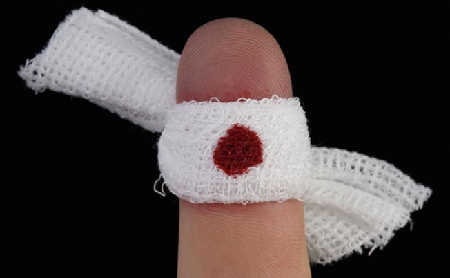 Врач назвал быстрый способ остановить кровь из порезанного пальца