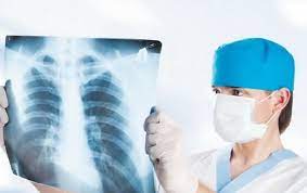 В Украине уменьшилась заболеваемость туберкулезом
